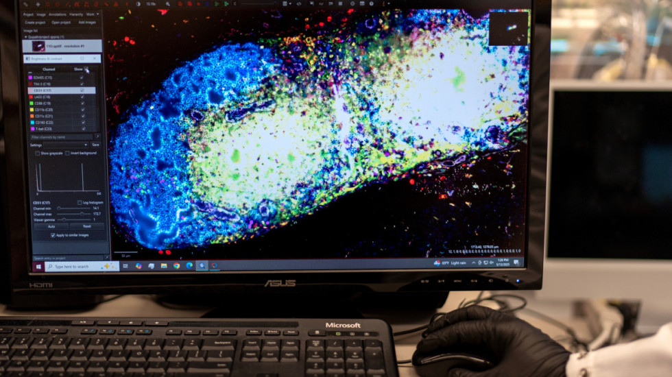 Przełomowa szczepionka na raka trzustki może przedłużyć pacjentom życie nawet o 6 lat